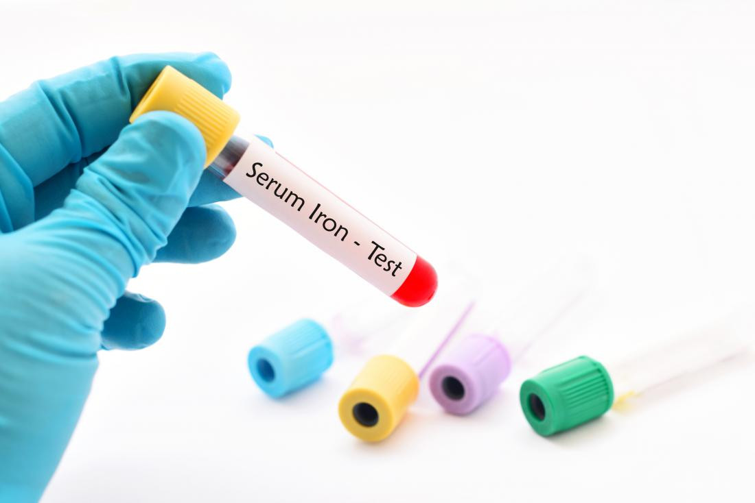Serum Iron